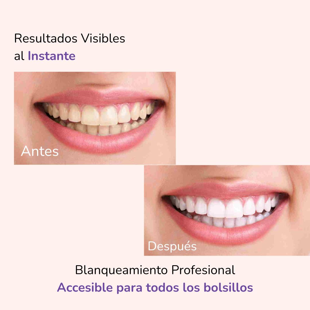 Blanqueador Purple Luxe Whitening v34® | Edición Limitada