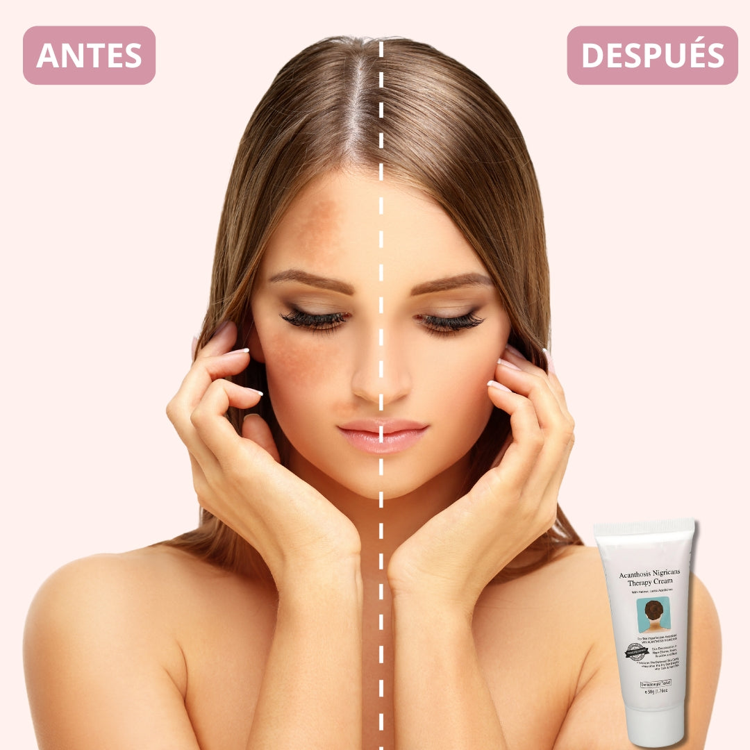 Crema Body Whitening Premium Therapy® | Edición Limitada