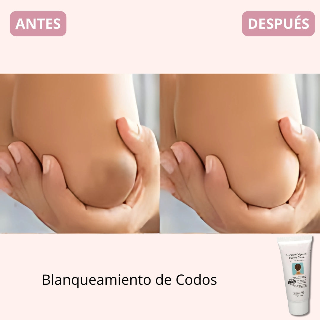 Crema Body Whitening Premium Therapy® | Edición Limitada