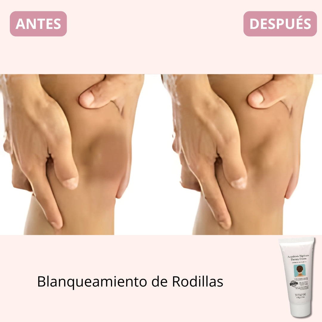 Crema Body Whitening Premium Therapy® | Edición Limitada