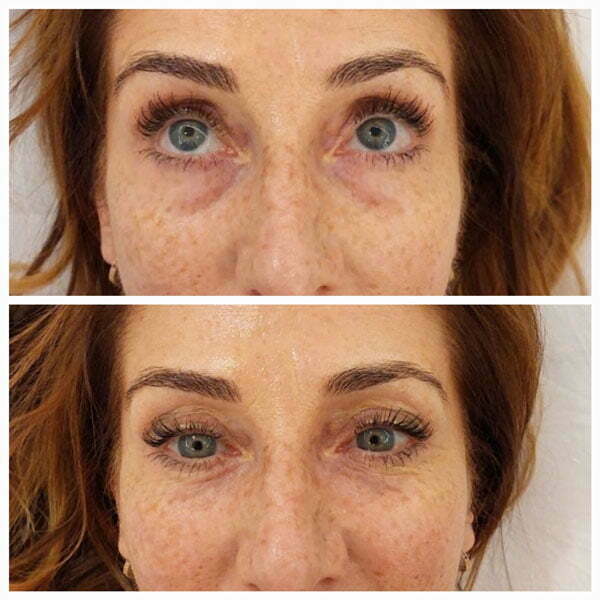 Serum Anti-Arrugas Enhancing Eye Lift®
