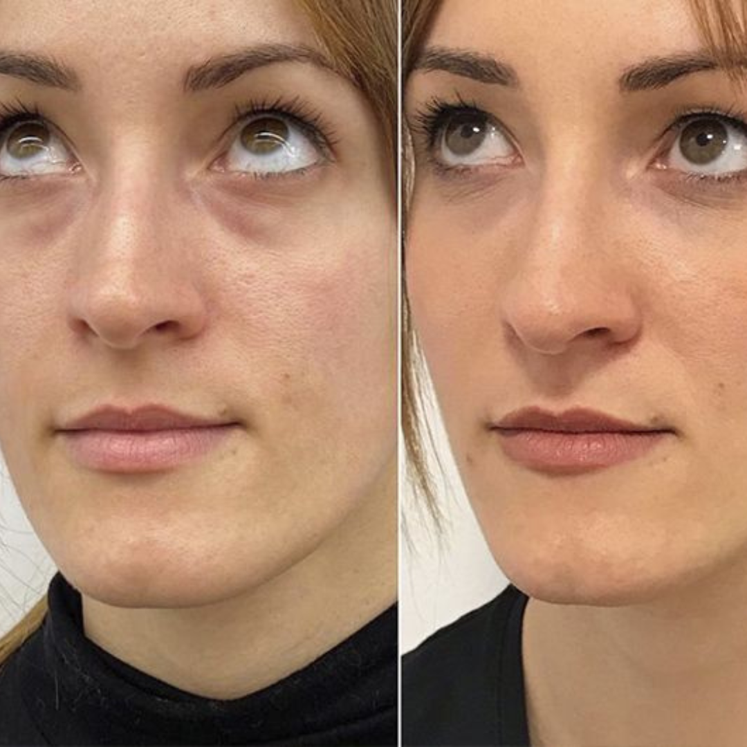 Serum Anti-Arrugas Enhancing Eye Lift®