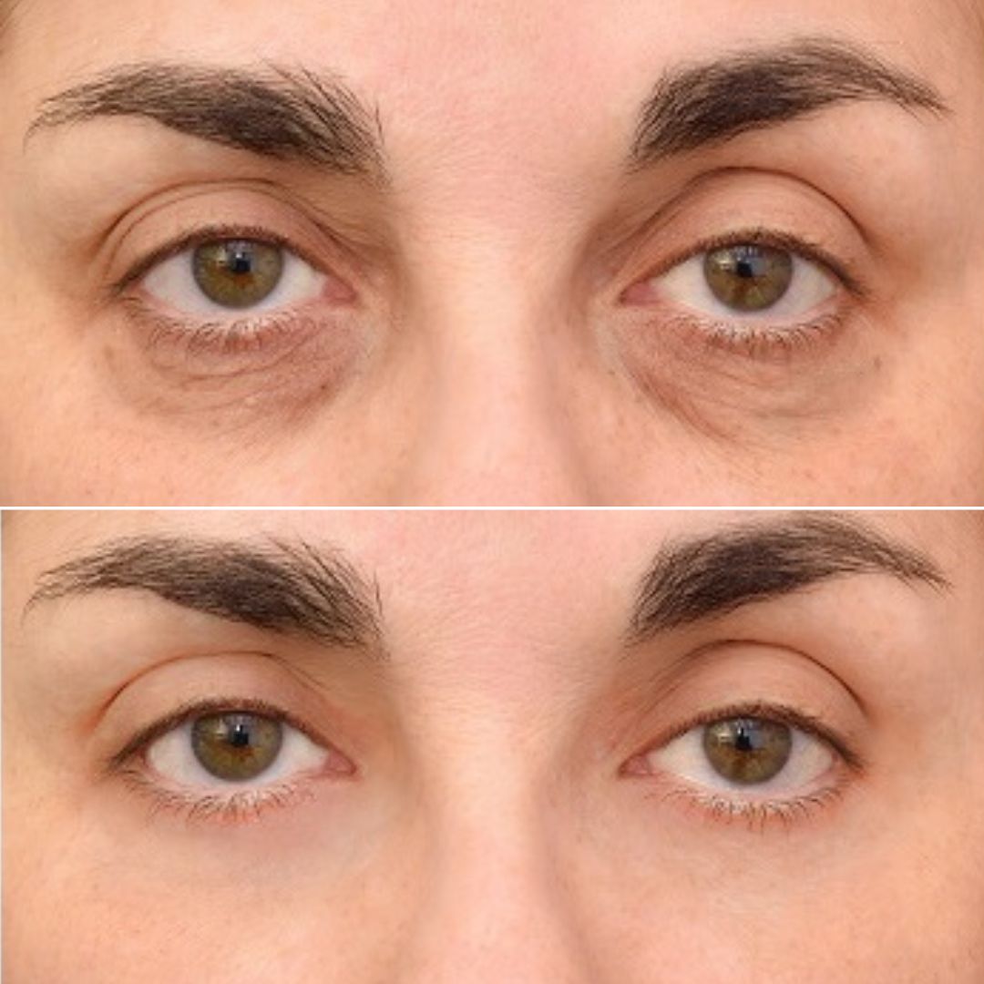 Serum Anti-Arrugas Enhancing Eye Lift®
