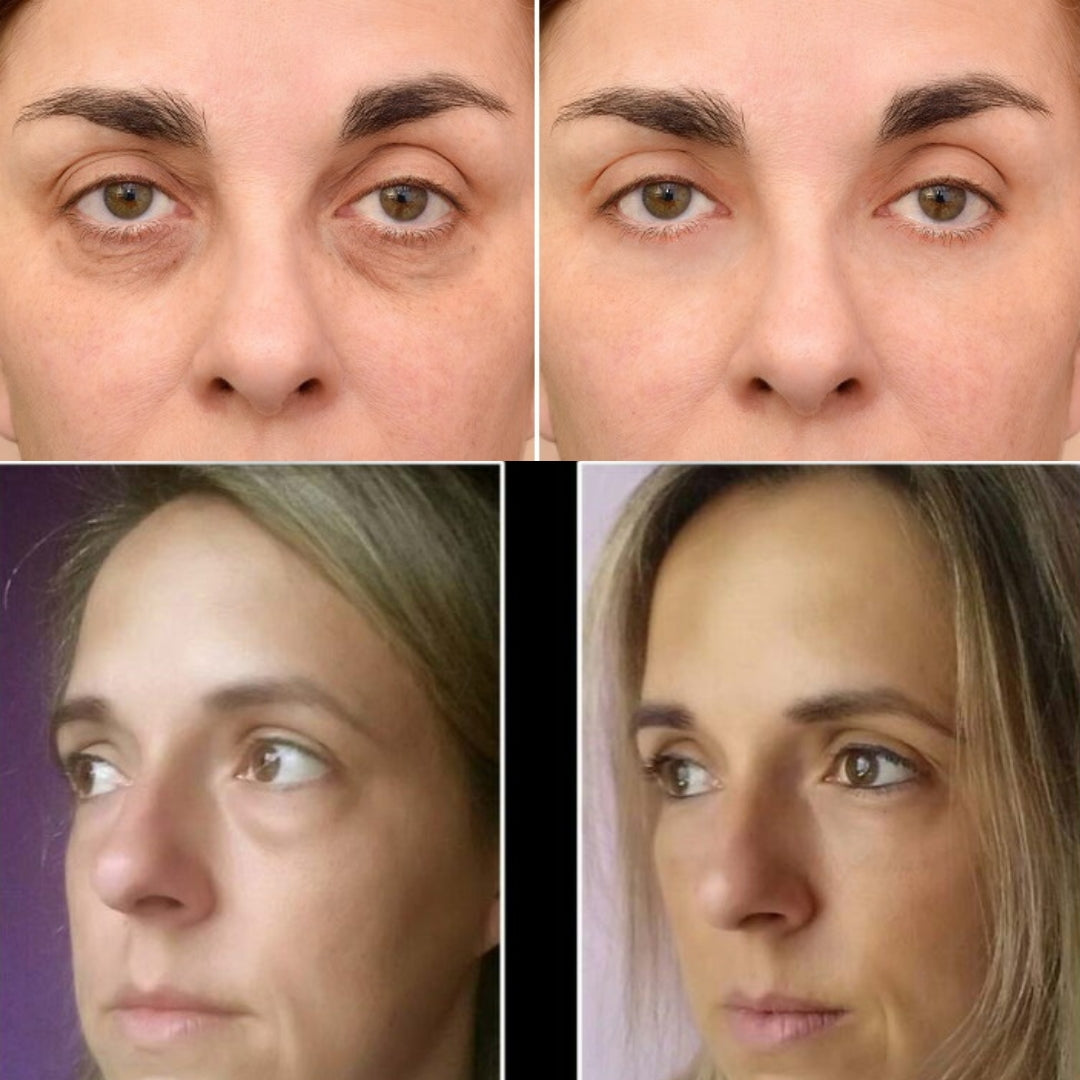 Veze EyeCream® | Elimina Ojeras y Bolsas x5 en 7 Días