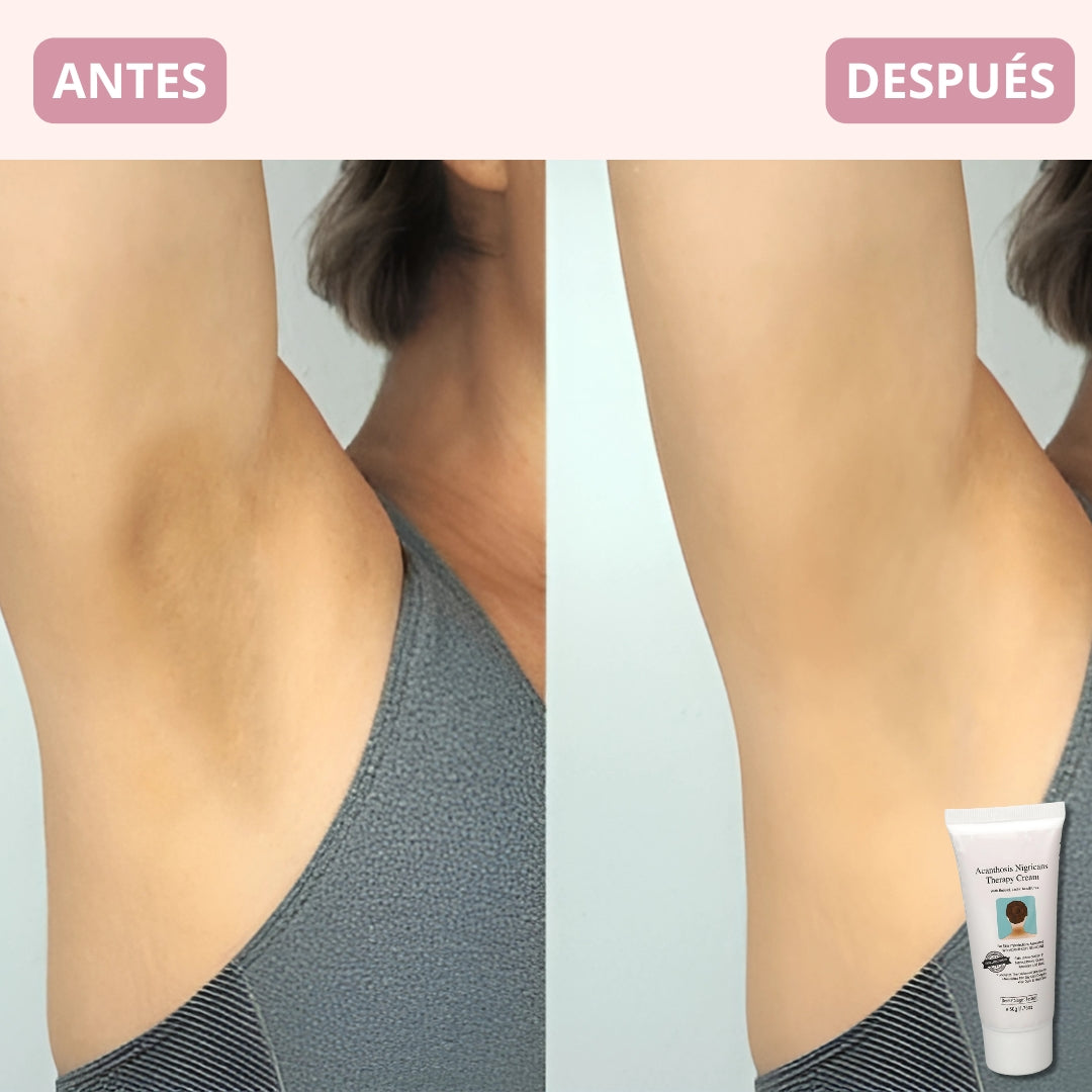 Crema Body Whitening Premium Therapy® | Edición Limitada