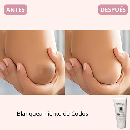 Crema Body Whitening Premium Therapy® | Edición Limitada