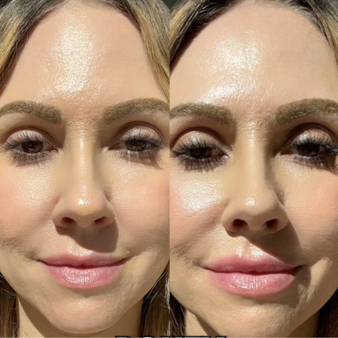 Voluminizador Derol hylarious PlumpMaxx® | Labios Más Llenos y Definidos en 30 Segundos — Sin Agujas ni Rellenos