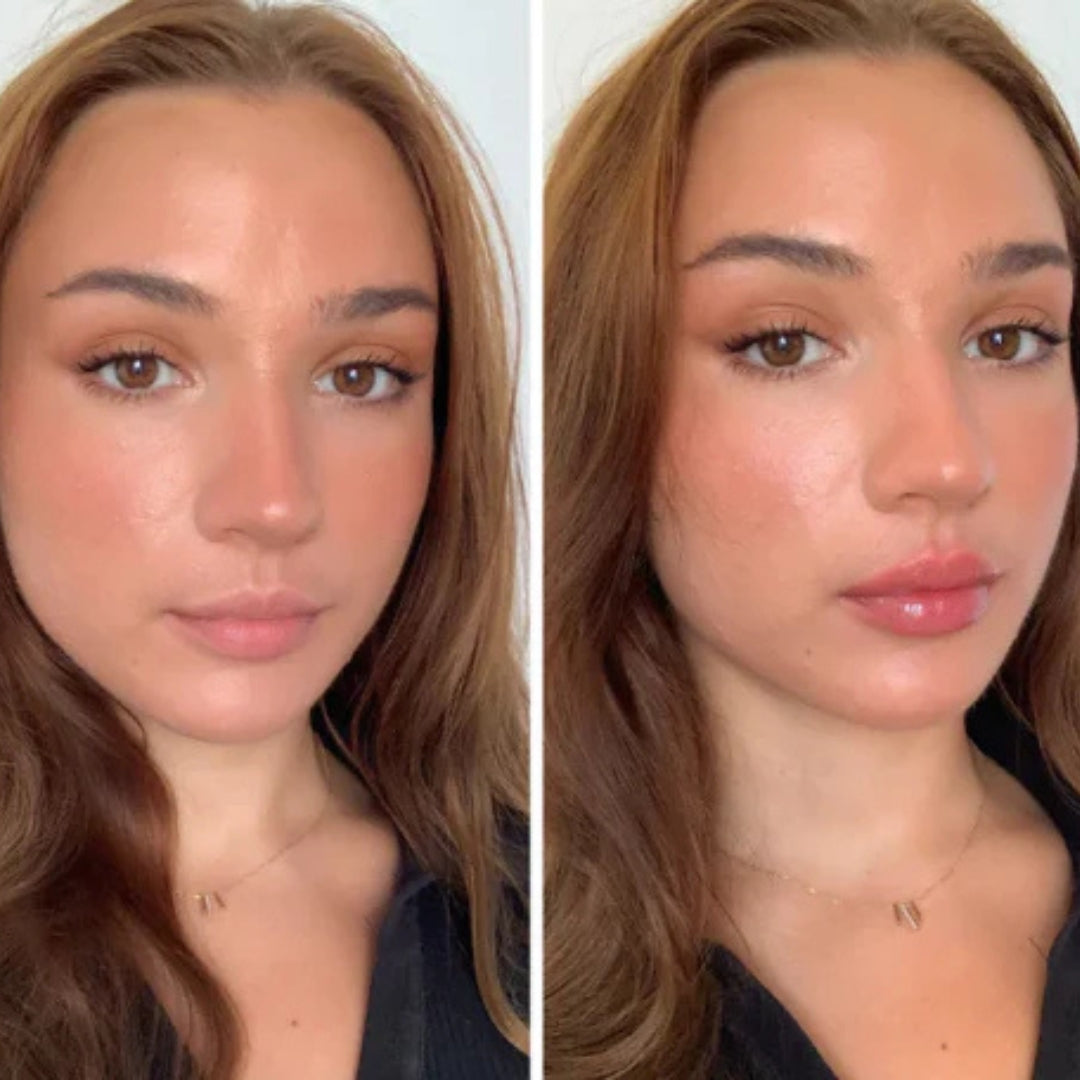 Voluminizador Derol hylarious PlumpMaxx® | Labios Más Llenos y Definidos en 30 Segundos — Sin Agujas ni Rellenos