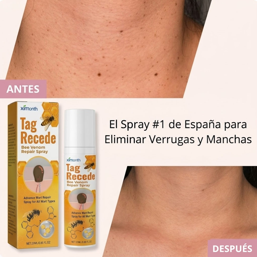 Tag Recede® | Elimina Verrugas y Fibromas x5 en 7 Días