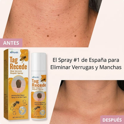 Tag Recede® | Elimina Verrugas y Fibromas x5 en 7 Días