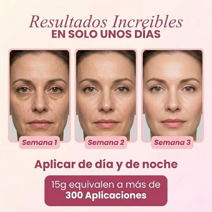 Veze EyeCream® | Elimina Ojeras y Bolsas x5 en 7 Días